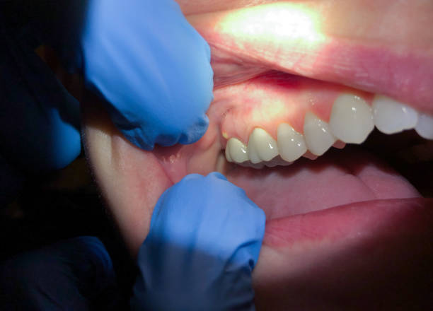 Best Broken Tooth Emergency  in Hoopa, CA